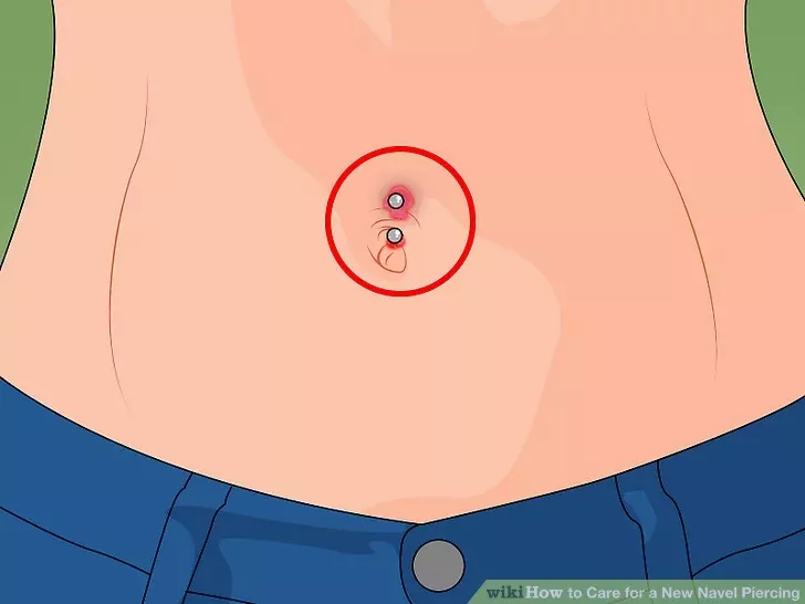 Infection nombril piercing prévention