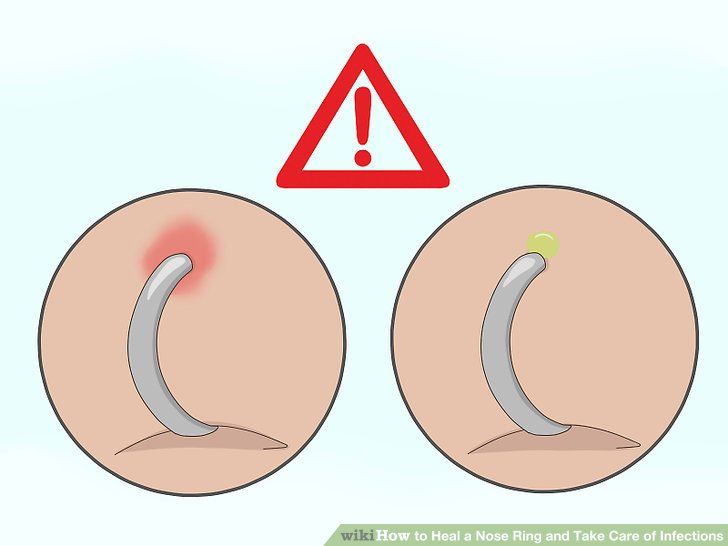 Cicatrisation nez piercing soins