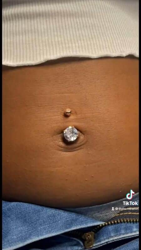 Nombril piercing problèmes